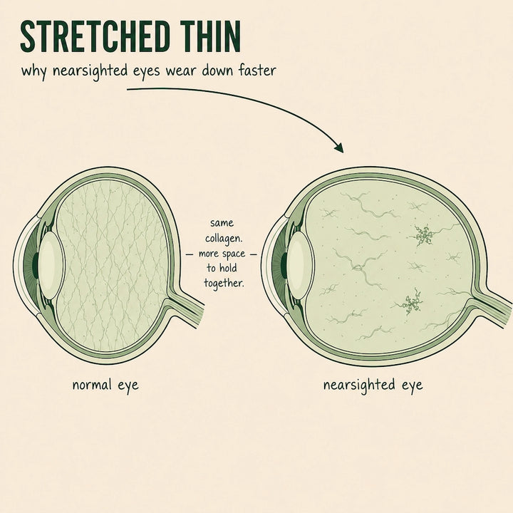 2. Nearsighted Eyes Break Down Collagen Faster