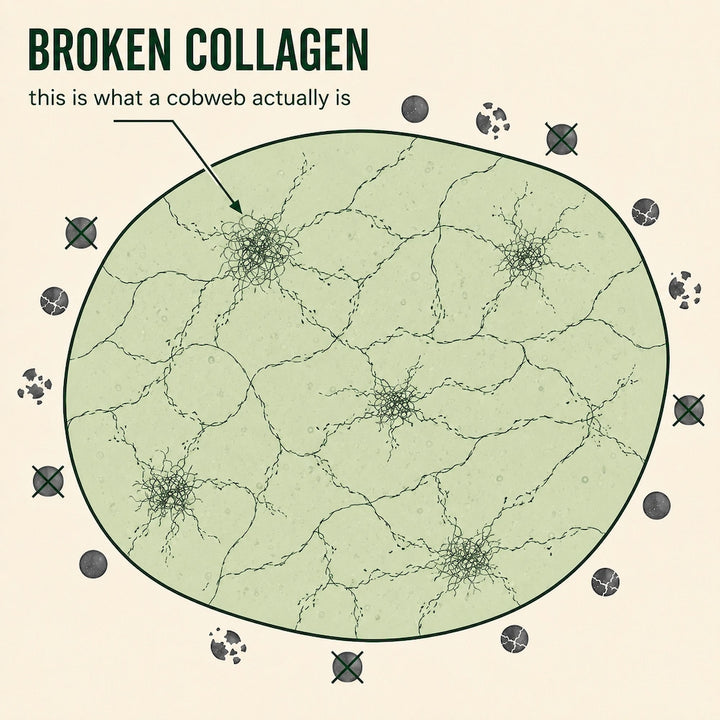 1. Every Cobweb You See Is A Piece Of Broken Collagen